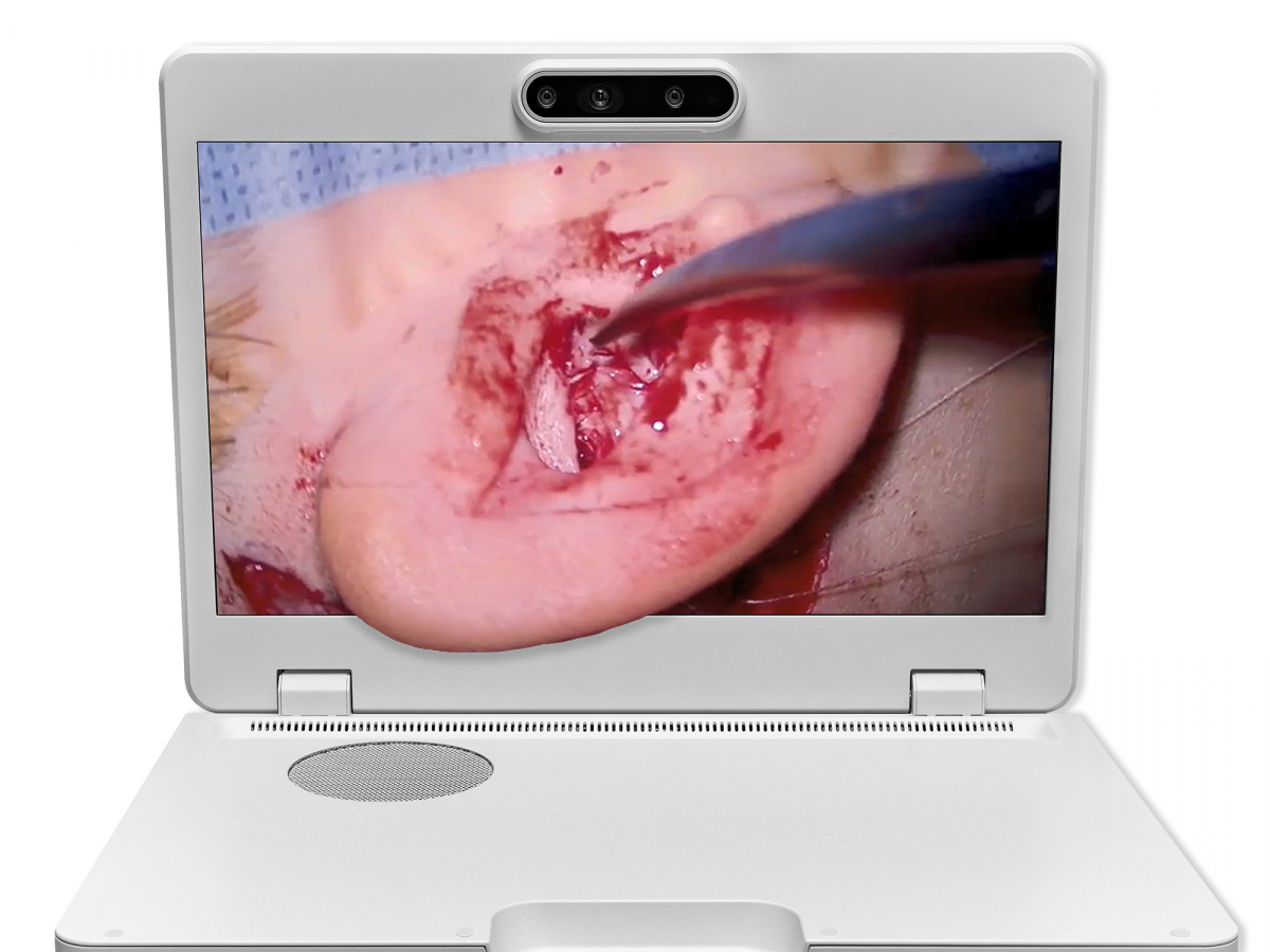 达擎之＂Heads-up 3D显微手术显示系统＂，整合4K裸眼3D显示及眼球追踪系统，具备快速追踪人眼移动位置功能，减轻医师长时间维持固定姿势的负担，让医师能有更宽广清晰的3D立体视野及更舒适的姿势来执行手术。